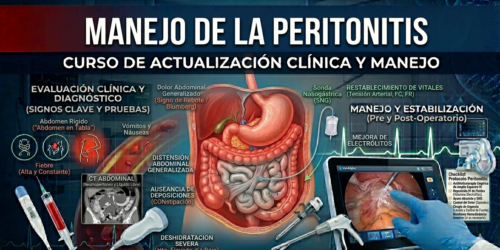 Peritonitis