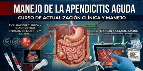 Apendicitis