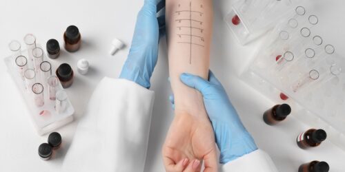 Sepsis